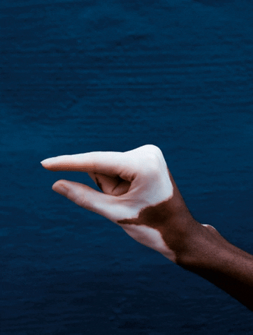 Vitiligo Hand Emoji